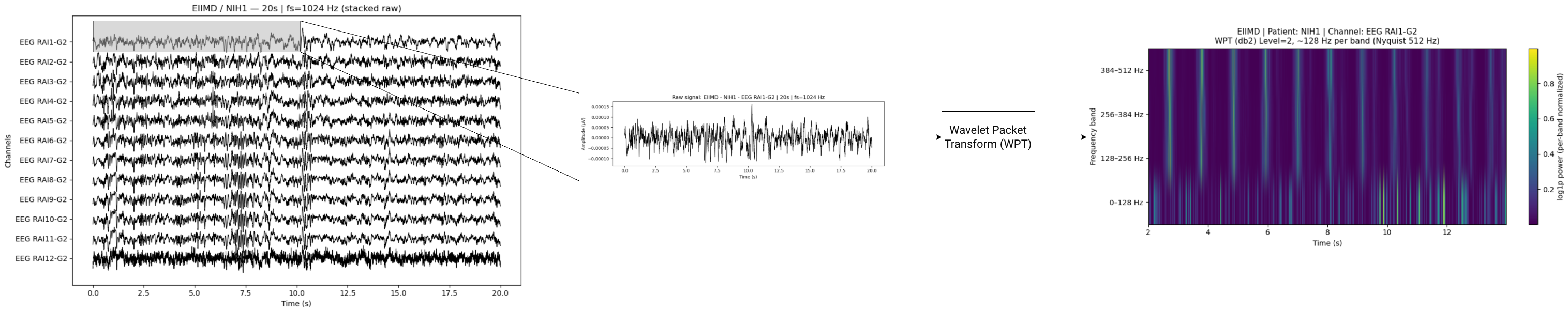 Preprocessing architecture pipeline
